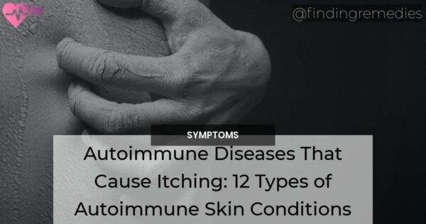 Autoimmune Diseases That Cause Itching: 12 Types of Autoimmune Skin ...