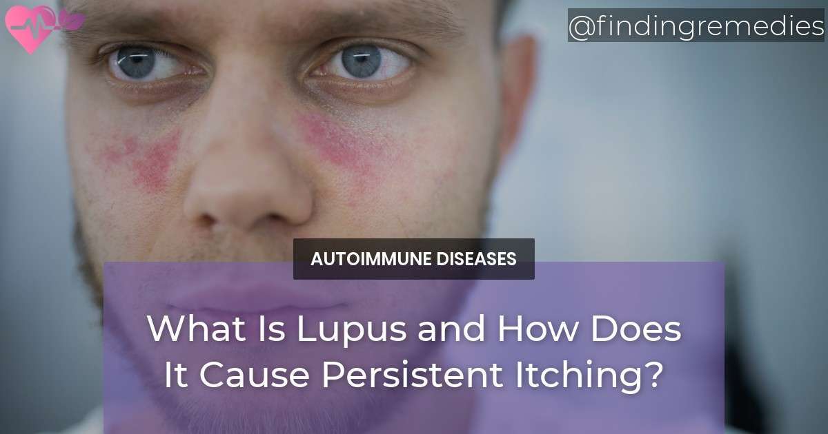 Lupus and Skin Itching: Understanding How It Causes Persistent Itching ...