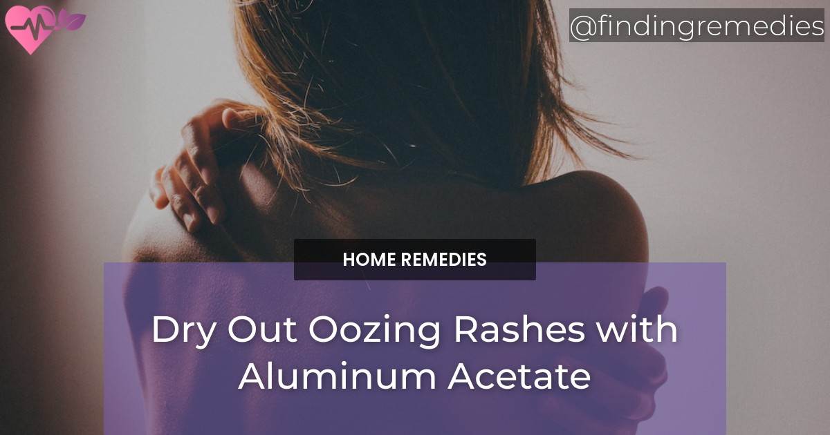 Dry it Out Aluminum Acetate for Oozing Rashes Finding Remedies